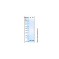 Recombinant Human UbcH5b/UBE2D2 Protein