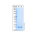 Recombinant Human UbcH7/UBE2L3 Protein