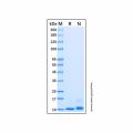 Recombinant Human CXCL2/GRO beta Protein