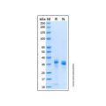 Recombinant Human Cathepsin L Protein