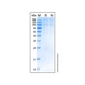 Recombinant Human TGF-beta RIII Protein