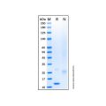 Recombinant Mouse IL-31 Protein