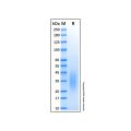 Recombinant Human CD79a Protein