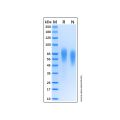 Recombinant Human TrkB Protein