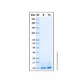 Recombinant Mouse CXCL2 Protein