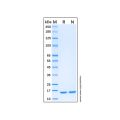 Recombinant Human GMFB Protein