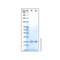 Recombinant Human UCH-L1/PGP9.5 Protein