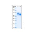 Recombinant Human PDGF R beta Protein