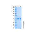 Recombinant Human 6-Phosphogluconate Dehydrogenase/PGD Protein