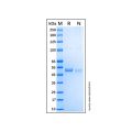 Recombinant Human Aurora A Protein