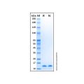 Recombinant Human Caveolin-1 Protein