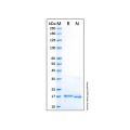 Recombinant Human eNOS Protein