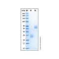 Recombinant Human LOX-1/OLR1 Protein