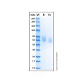 Recombinant Human Tyro3/Dtk Protein