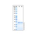Recombinant Human CDK4 Protein