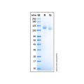 Recombinant Human ROBO1/DUTT1 Protein