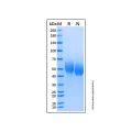 Recombinant Human IL-1 RI Protein