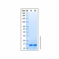 Recombinant Equine IL-1 beta/IL-1F2 Protein