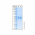 Recombinant Human DDR2 Protein