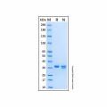 Recombinant Human DEP-1/CD148 Protein