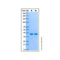 Recombinant Human CSNK2A2 Protein