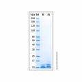 Recombinant Human beta Defensin 5 Protein