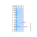 Recombinant Human Proteasome subunit beta type 2/PSMB2 Protein