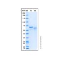 Recombinant Human SMAD4 Protein