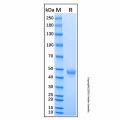 Recombinant Human Activin RIA/ALK-2 Protein