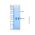 Recombinant Human Serpin A1/alpha-1-Antitrypsin Protein