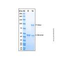 Recombinant Human Cathepsin E Protein