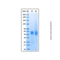 Recombinant Human NOV/CCN3 Protein