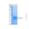 Recombinant Human CD300f/LMIR3 Protein