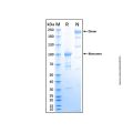 Recombinant Human EphA8 Protein