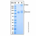 Recombinant Human Lysosomal alpha-Glucosidase/GAA Protein