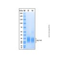 Recombinant Human GLP-1R Protein