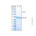 Recombinant Human Hexosaminidase B/HEXB Protein