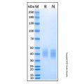 Recombinant Human IFN-gamma R1 Protein