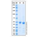 Recombinant Human IL-11 R alpha Protein