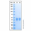 Recombinant Human IL-22BP Protein