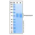 Recombinant Human IFN-alpha/beta R1 Protein