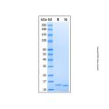 Recombinant Human Lysozyme protein