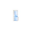 Recombinant Human Netrin-G1a Protein