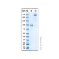 Recombinant Human Nogo Receptor Protein