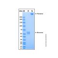 Recombinant Human Neuronal Pentraxin 2 Protein