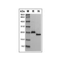 Recombinant Human RANK Protein