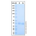 Recombinant Human RSPO1 Protein