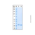Recombinant Human Pentraxin 2/SAP Protein