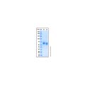 Recombinant Human SMOC-1 Protein