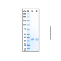 Recombinant Human TRACP/PAP/ACP5 Protein